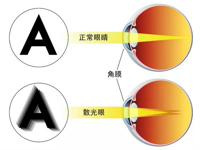 爱眼护眼3