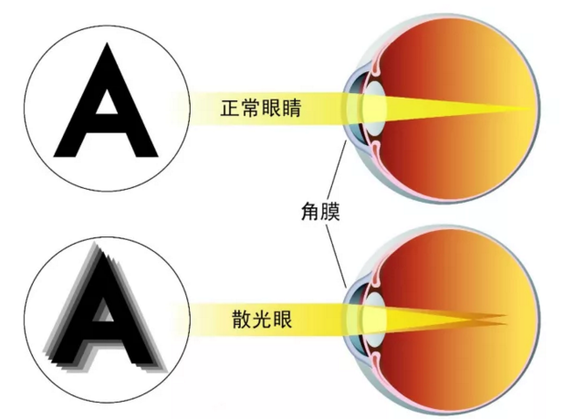 保护视力