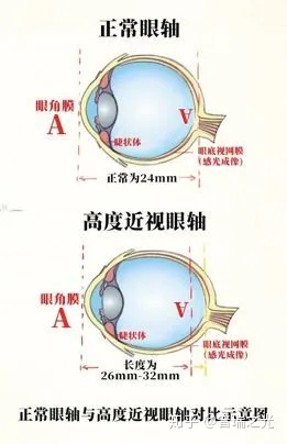 5种眼病1